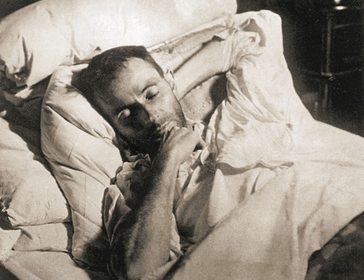 Influenza si vybírala oběti i mezi slavnými. Na fotografii malíř Egon Schiele na smrtelném loži.