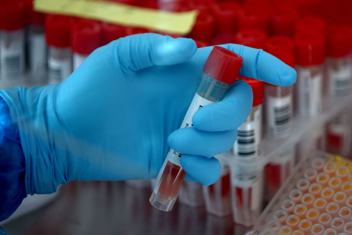 Test odebraného vzorku na přítomnost koronaviru v laboratoři ve Vídni