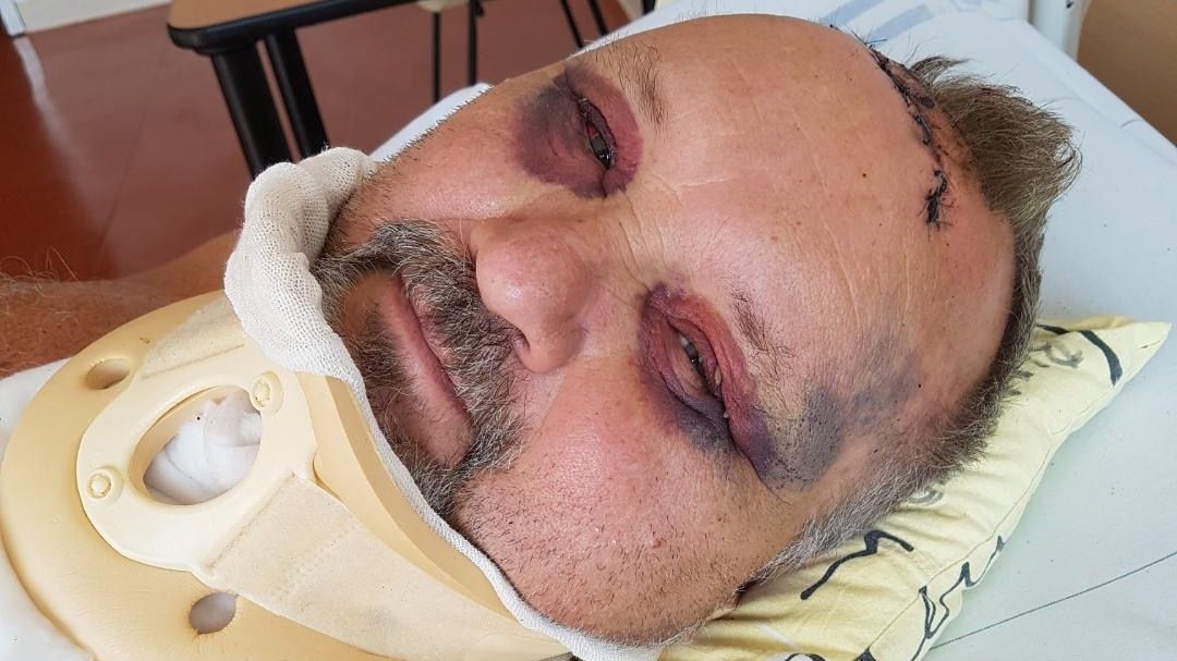 Vážně zraněný Kováčik zveřejnil fotku z nemocnice