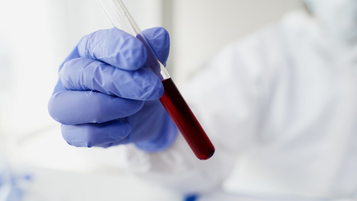 Americký krevní test může zachytit rakovinu již v raném stadiu
