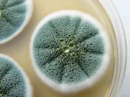 Znáte ji z plesnivého chleba. A ráda se drží na vlhkých stěnách a stropech, pod podlahovou krytinou i za obklady stěn. 