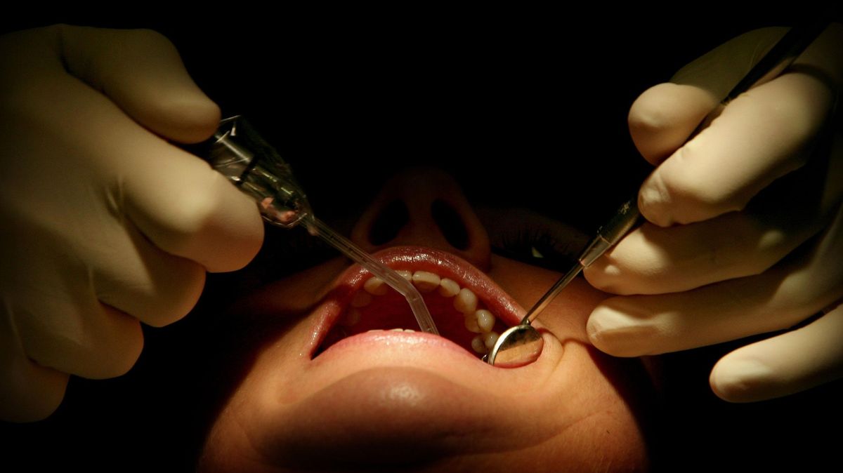 Američanka zažalovala svého zubaře, který jí najednou provedl přes 30 zákroků