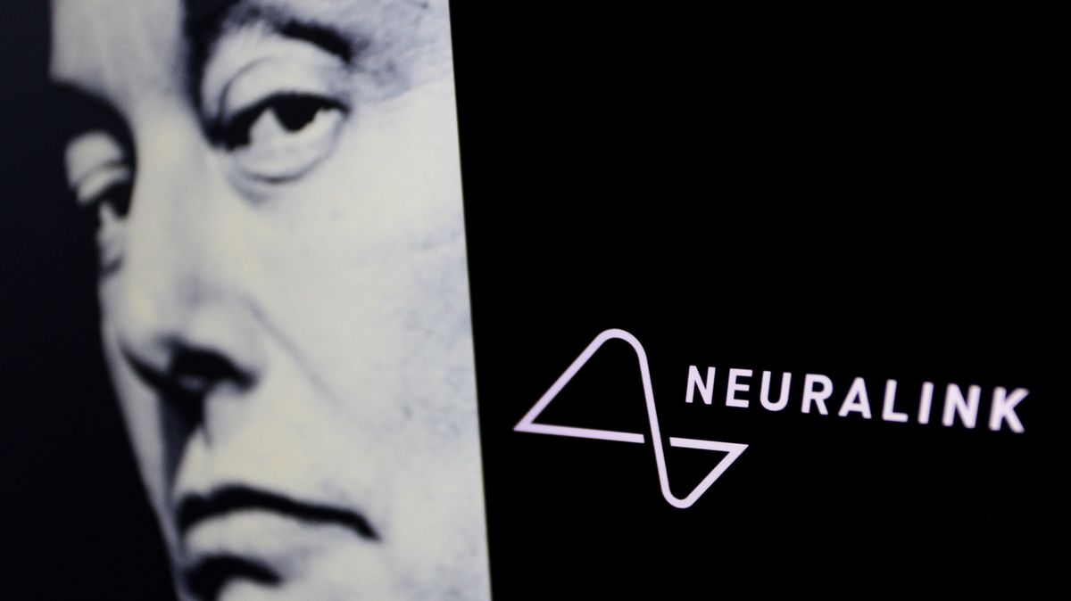 Pacientovi s Neuralinkem se začal odpojovat čip od mozku