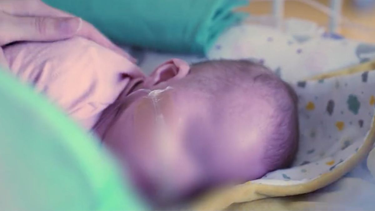 Lékaři v Motole transplantovali srdce tříměsíční holčičce