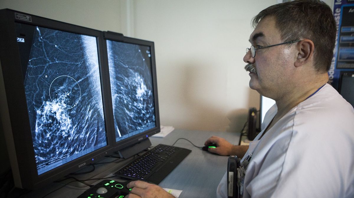 Umělá inteligence pomáhá zjistit nádor prsu