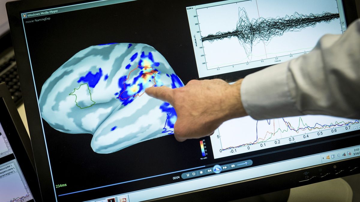 Třináctiletému Britovi dali jako prvnímu pacientovi s epilepsií do lebky neurostimulátor