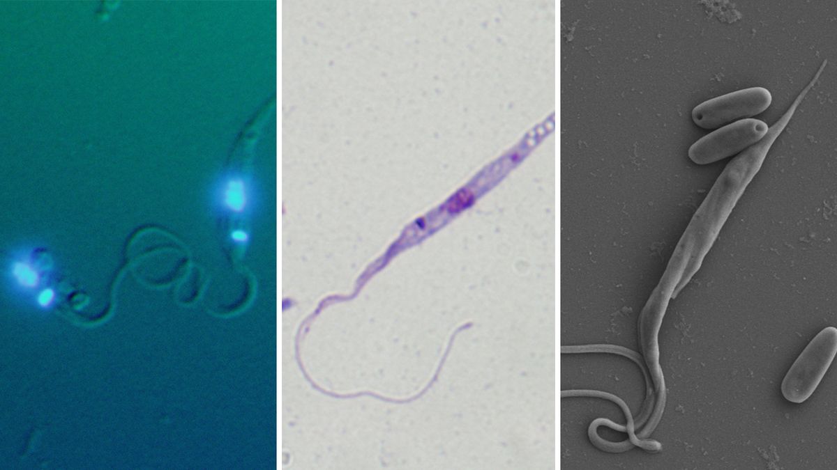 Čeští biologové objevili parazita se záhadným genetickým kódem. A rozluštili ho