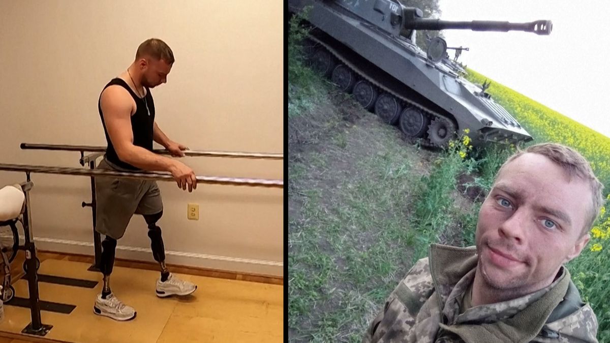 V květnu přišel o obě nohy, den po výročí války se Ukrajinec s protézami vrací do boje