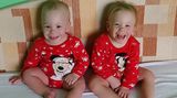 Dvojčata se narodila předčasně. Překonala zdravotní problémy i transplantaci jater