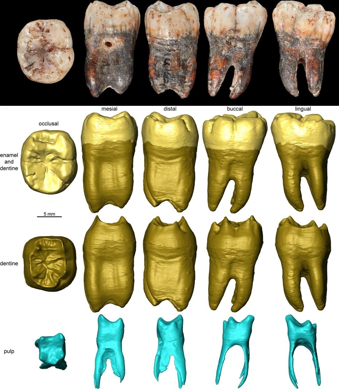 Snímky a 3D rekonstrukce zubu neandertálského dítěte