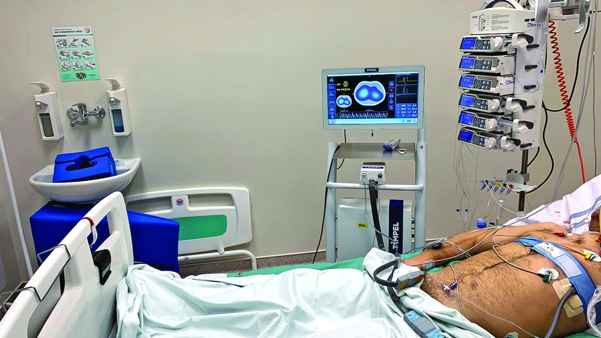 Plicní ventilaci ohlídá tomograf, ale v českých nemocnicích jsou jen dva