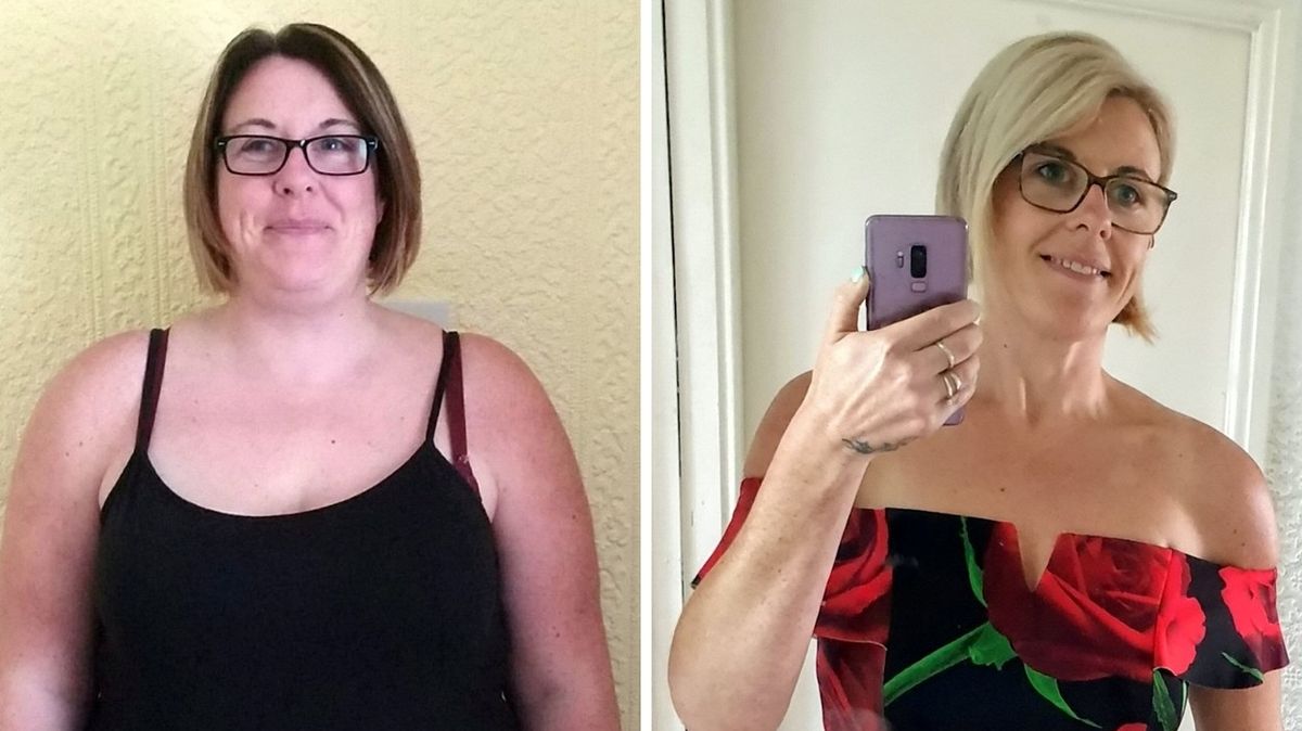 Ženě se povedlo zhubnout 57 kg i bez zmenšení žaludku