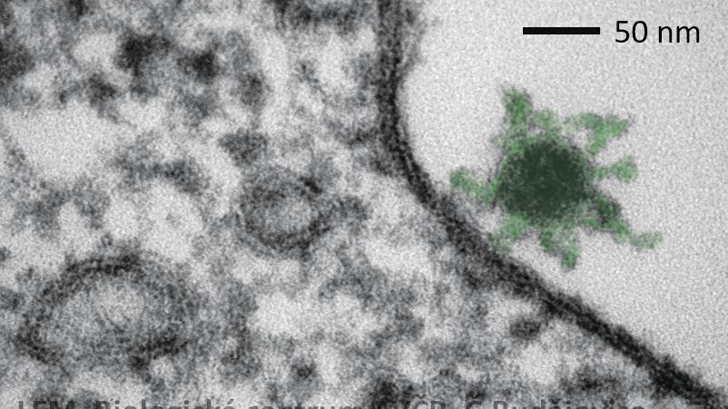 Brazilská mutace se snáz přenáší a odolává protilátkám, říká šéf laboratoře