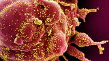 Británie zkoumá AY.4.2, novou variantu koronaviru