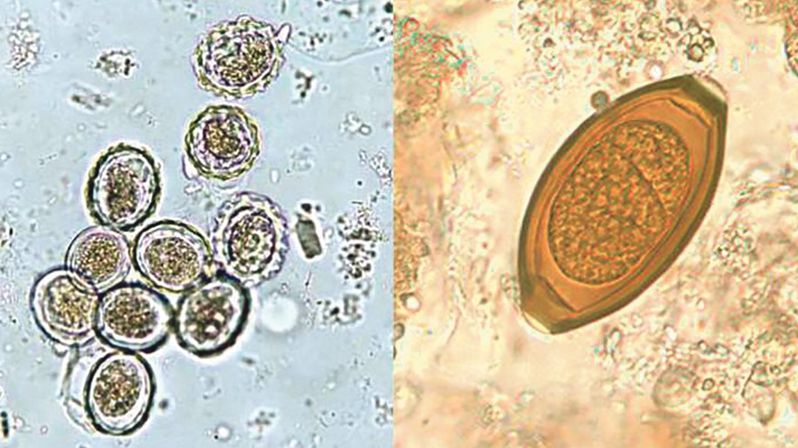 Škrkavkovití (vlevo) a tenkohlavci pod mikroskopem