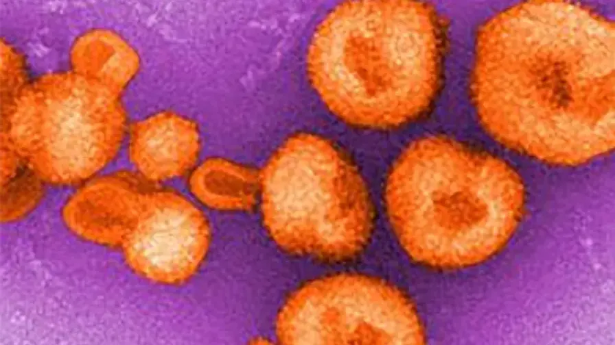 Viry z rodu arenavirů, kam patří i virus způsobující horečku chaparé (ilustrační foto)