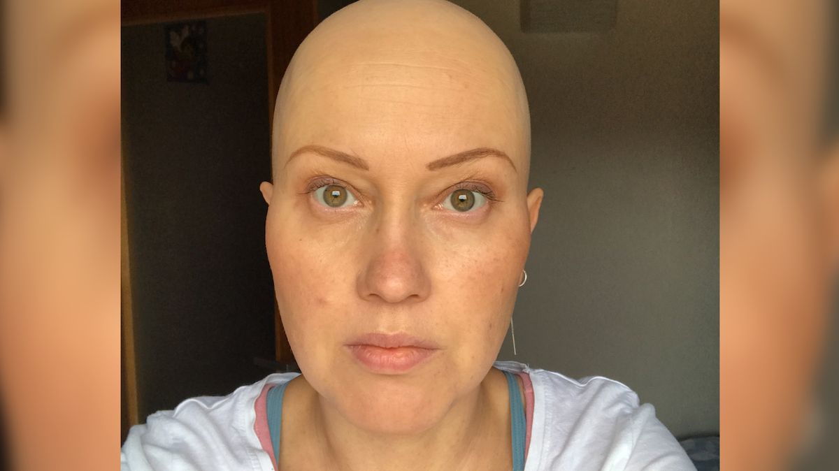 Kvůli chemoterapii přišla Eva o vlasy