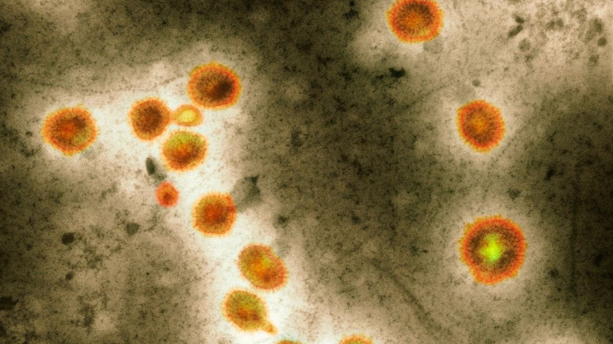 Čína ohlásila první případ lidské nákazy ptačí chřipkou