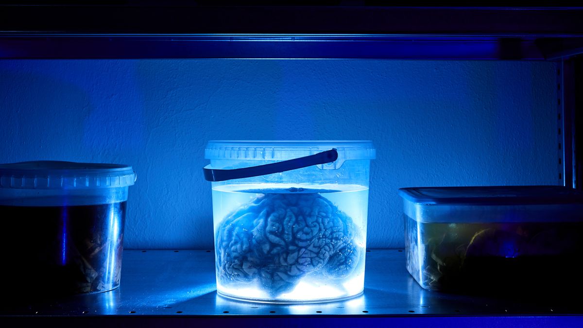 Vzorky mozkových tkání mohou pomoci s výrobou léků na neurodegenerativní onemocnění