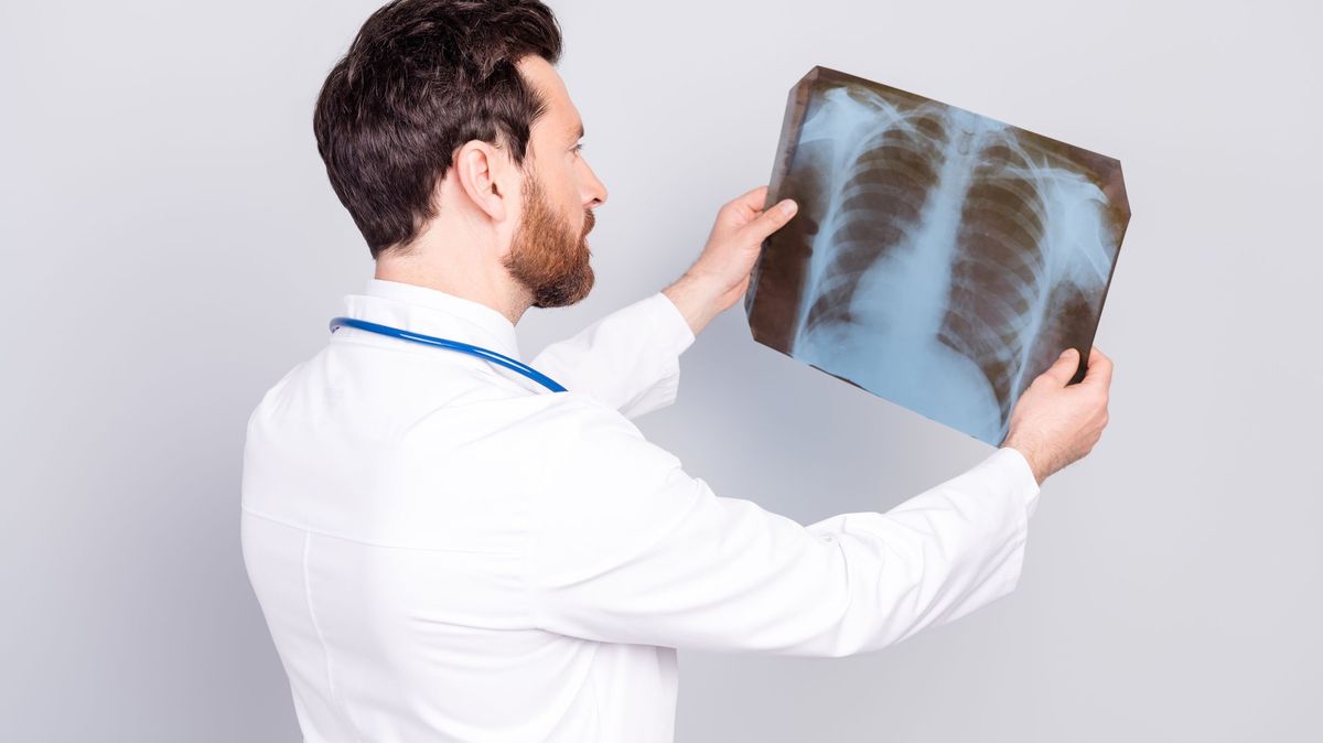 K diagnostice rakoviny plic dochází často pozdě. Příznaky podceňují nemocní a někdy i praktici