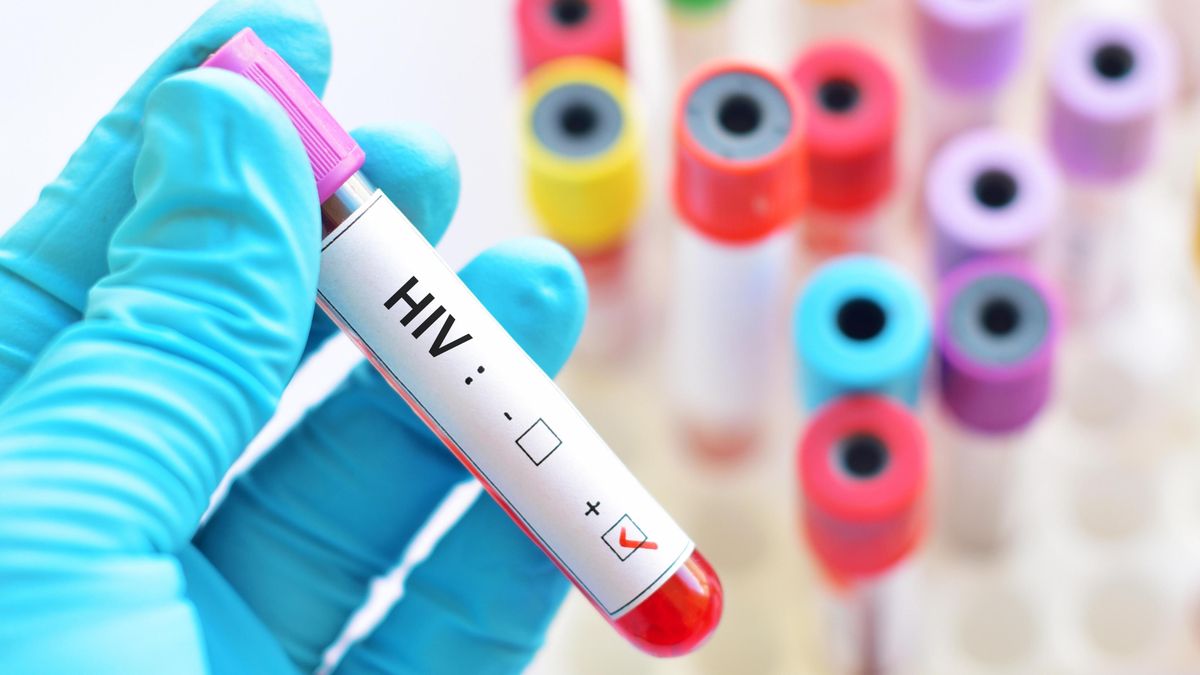 V Česku se nedaří zkrotit nákazu HIV, počty případů trhají rekordy