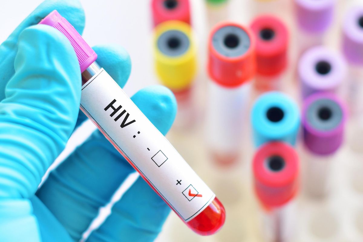 V Česku se nedaří zkrotit nákazu HIV, počty případů trhají rekordy