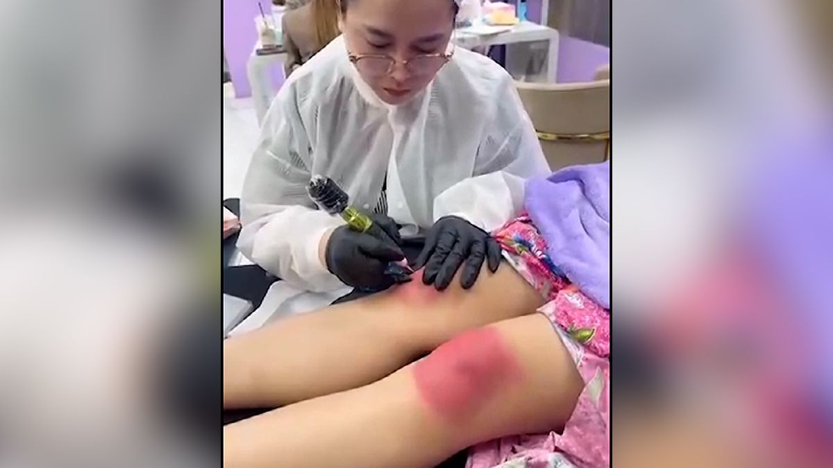 Jak vypadat mladší? Asiatky na to jdou přes kolena