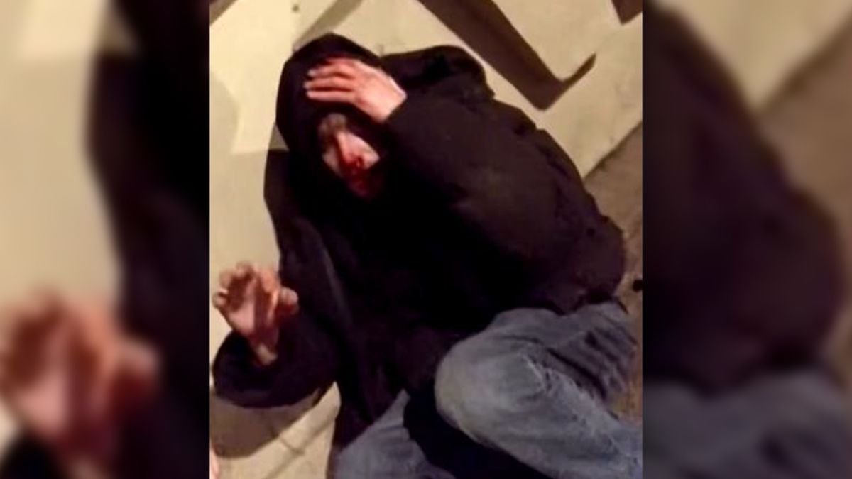 Policie hledá oběť brutálního napadení v Liberci