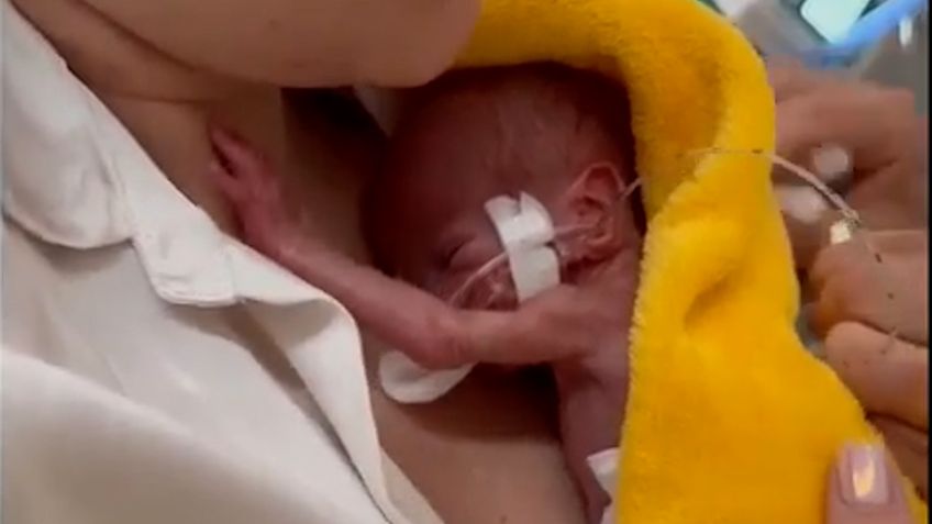 Anička vážila při porodu pouhých 350 gramů. Lékaři ji zachránili, pomohlo i klokánkování