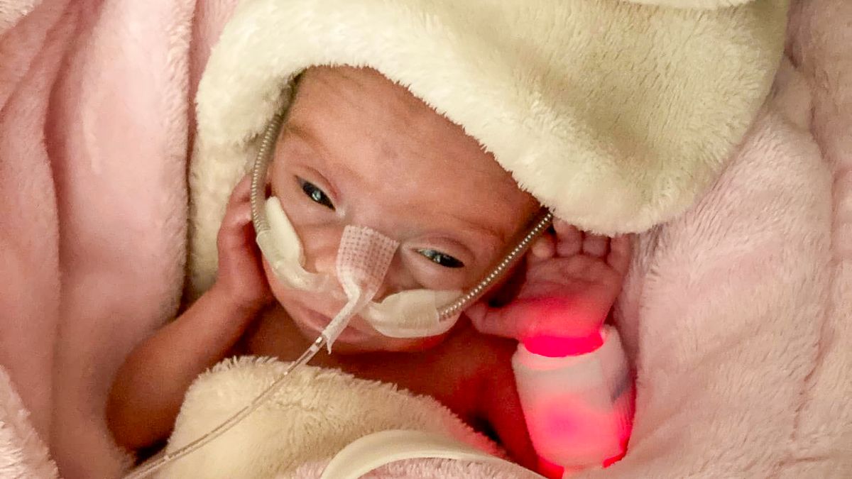 Viktorka se narodila s pouhými 386 gramy. Přes těžký start do života se jí daří dobře