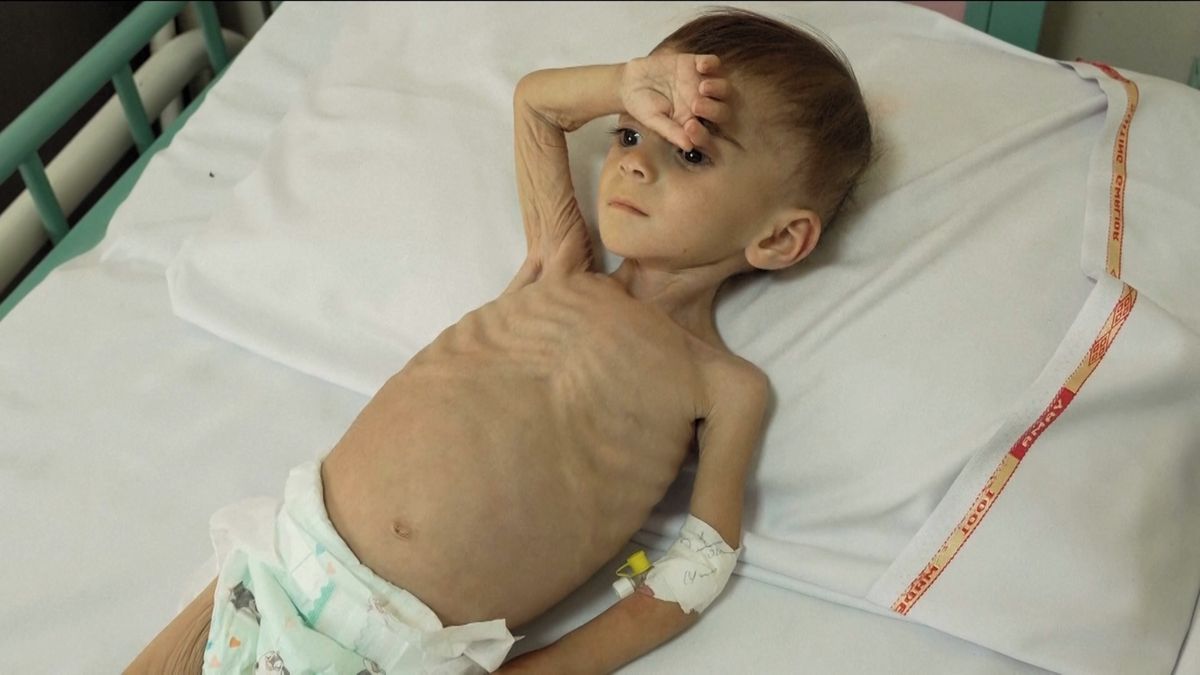 Už jsem přišla o tři děti. Afghánistán čelí drtivé krizi dětské podvýživy