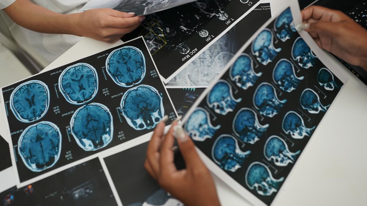 Roky jí tvrdili, že je na vině stres. Příčinou deformit a vleklých bolestí byla akromegalie