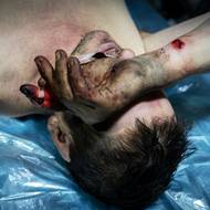 Zraněný ukrajinský voják v polní ošetřovně kousek od Lymanu. 22.února 2025.