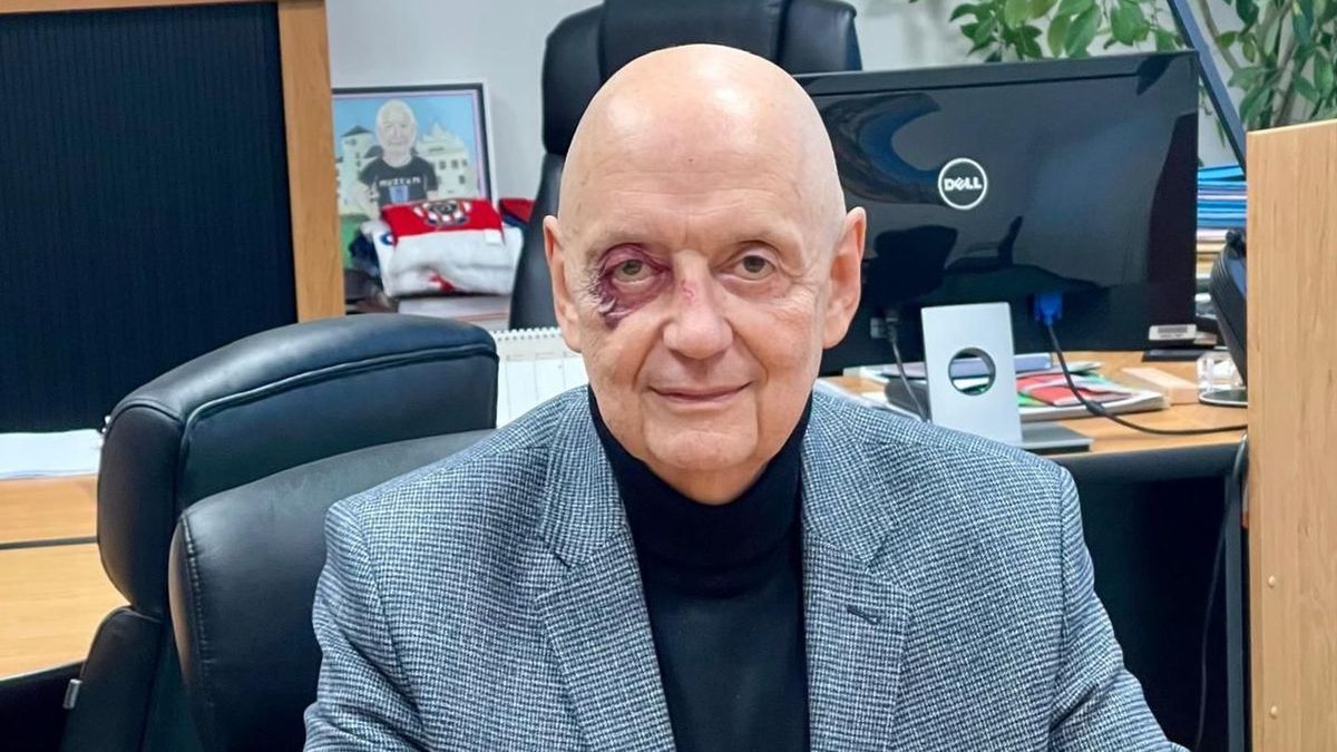 Blanenský starosta zveřejnil fotku s monoklem. S nikým jsem se neporval, ale fakt to klouže, říká