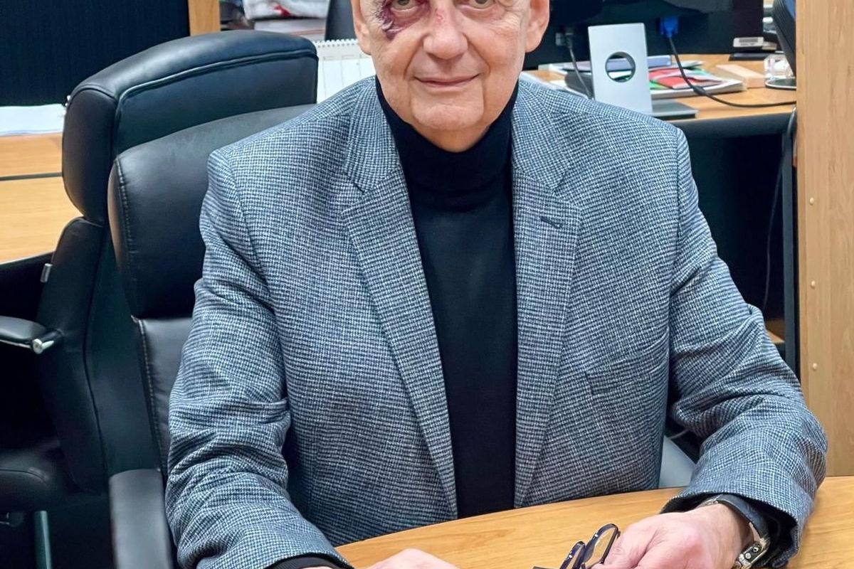 Blanenský starosta zveřejnil fotku s monoklem. S nikým jsem se neporval, ale fakt to klouže, varuje