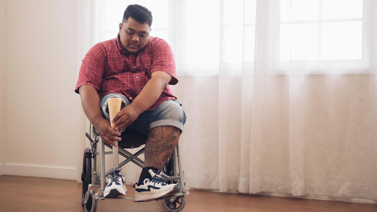 Ind si nechal amputovat nohu, aby jej přijali na medicínu