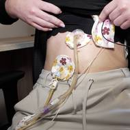 Julie je 24 hodin denně napojena na soustavu, která ji pomáhá s trávicími obtížemi.