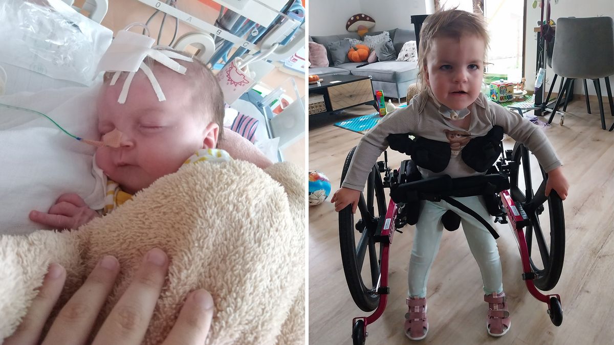 Teprve 53. na světě. Čtyřletá Diana se narodila s unikátní kombinací anomálií, čeští specialisté se s ní ještě nesetkali