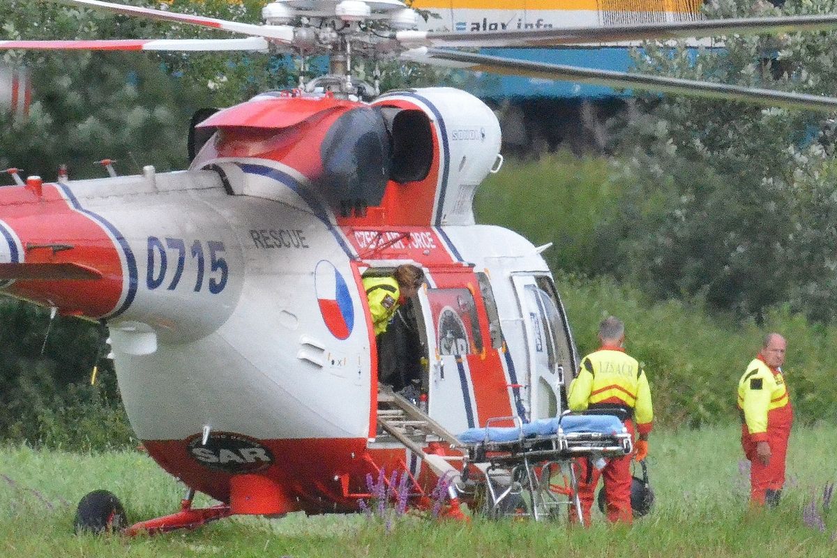 Pes na Karlovarsku zaútočil na dítě a vážně ho pokousal v obličeji 