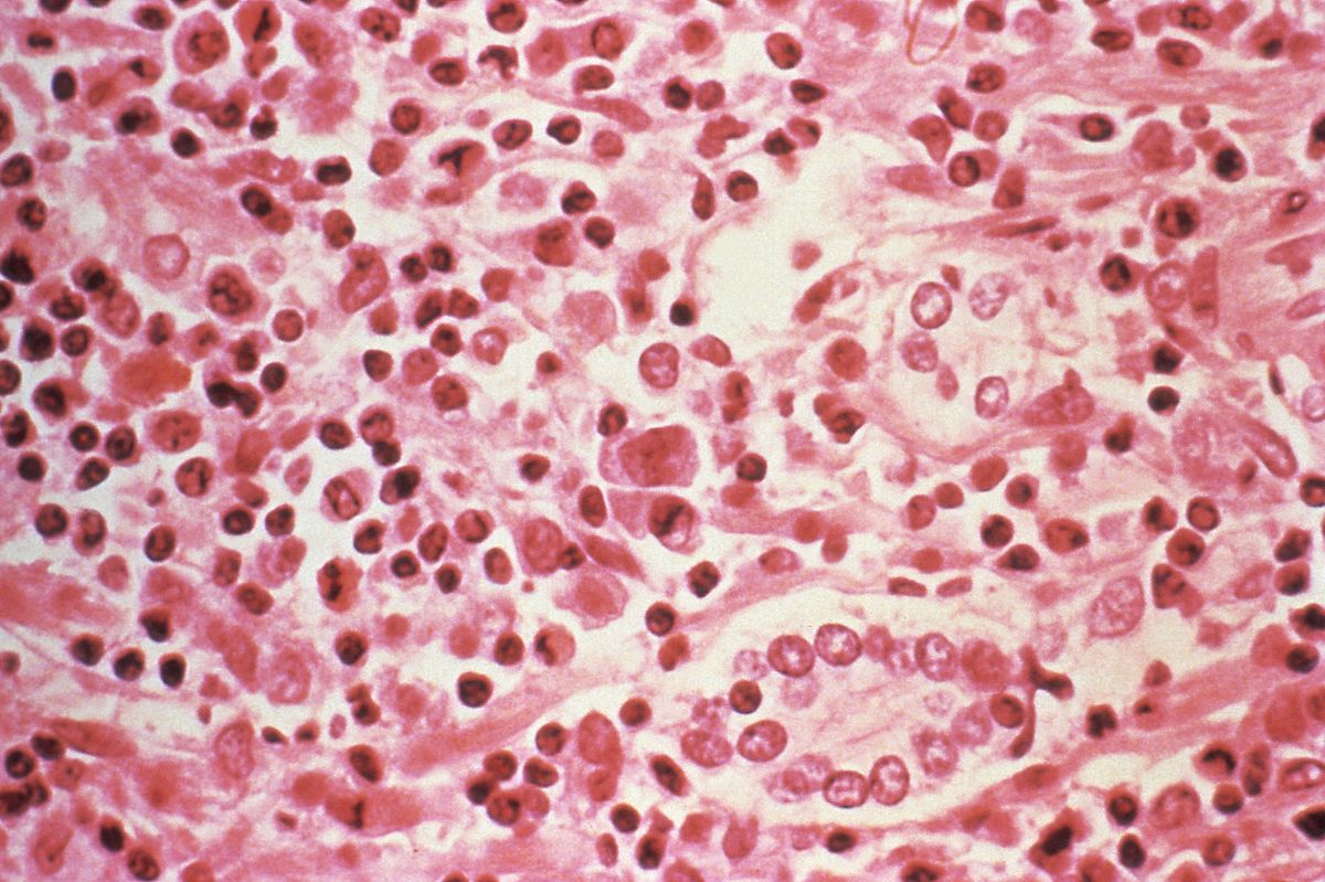 Po stopách pacientů nula. Epidemiologové hledají, kde se manželé nakazili smrtelným hantavirem