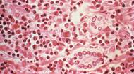 Po stopách pacientů nula. Epidemiologové hledají, kde se manželé nakazili smrtelným hantavirem