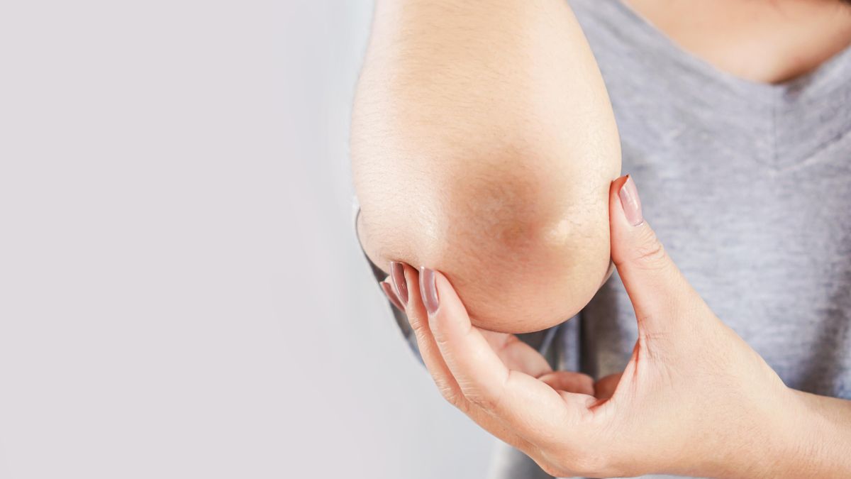Zastavte cukrovku dřív, než začne. Na prediabetes mohou upozornit fibromy a tmavé skvrny