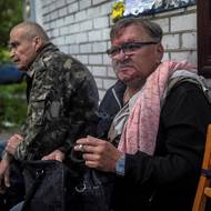 Jeden ze zraněných. Jevhen na noc nešel do krytu a jeho byt byl zasažen. Zraněný si dává cigaretu na zklidnění. 