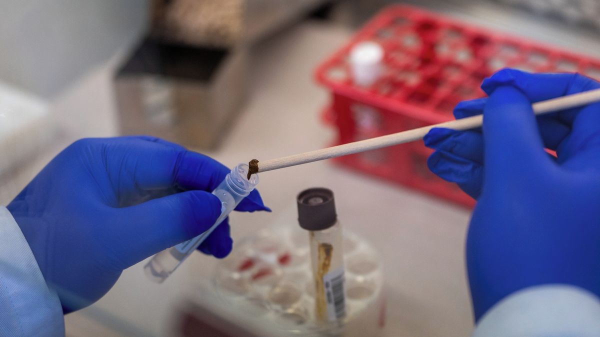 Epidemie salmonely pokračuje, nakaženo je i šest Čechů. Zdrojem jsou zřejmě instantní nudle